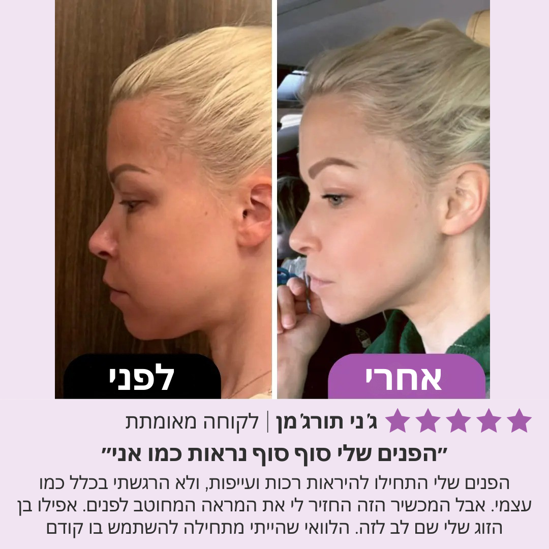 בונאליטי – רולר יופי לפנים