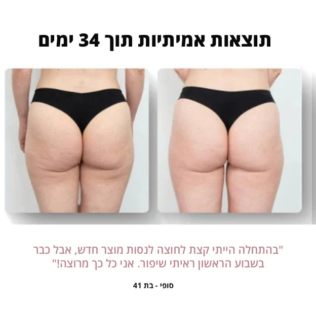 מסאג'ר אנטי-צלוליט