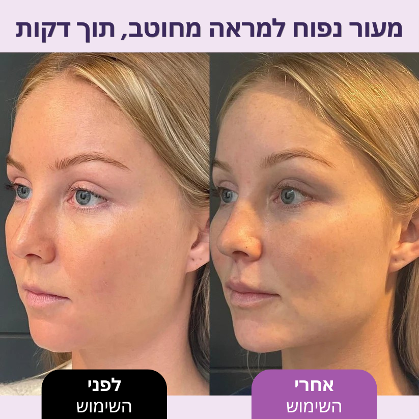 בונאליטי – רולר יופי לפנים