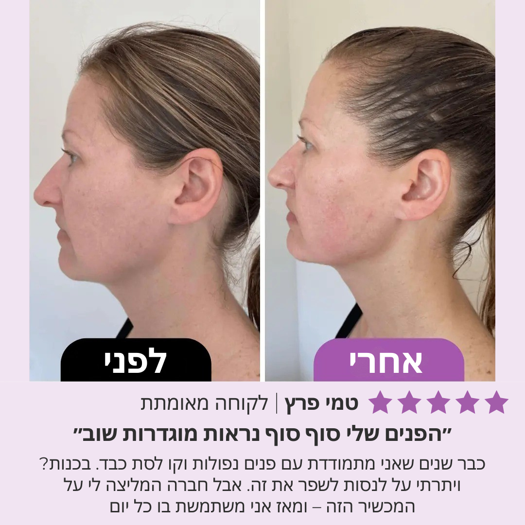 בונאליטי – רולר יופי לפנים