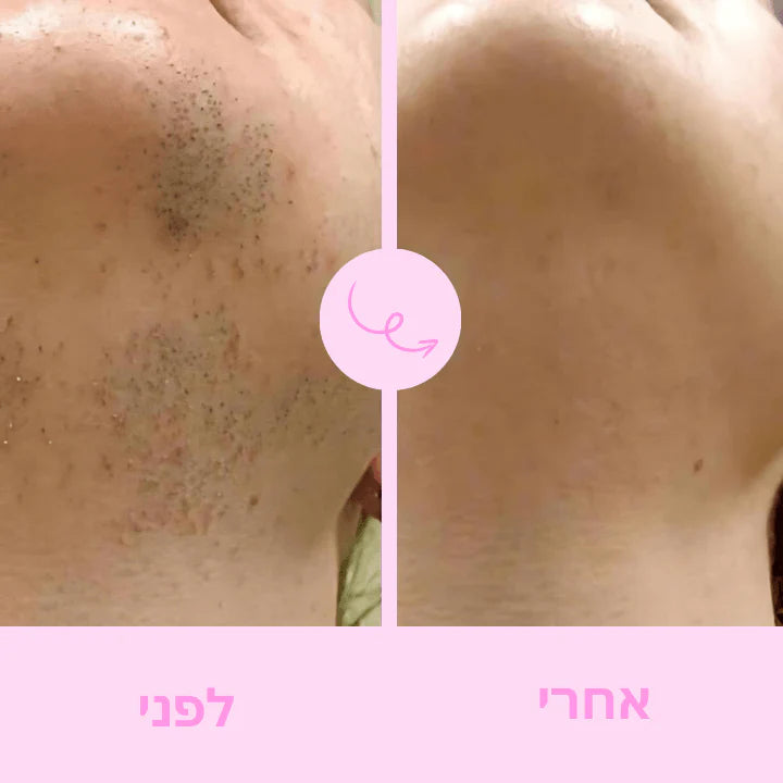 Boonality™  – מכשיר גילוח נשי מהיר ונוח
