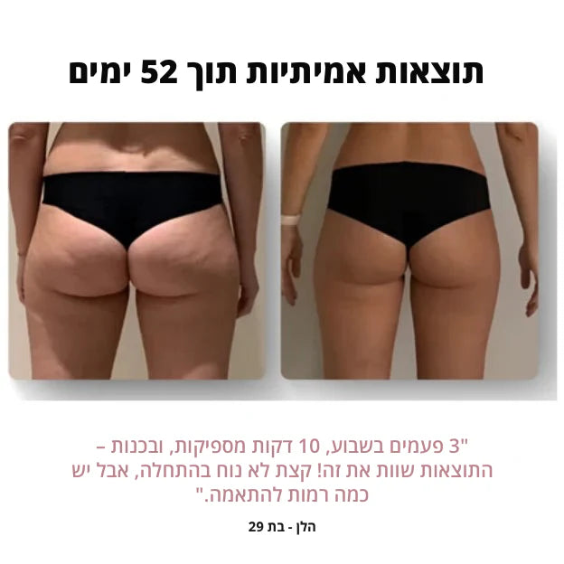 מסאג'ר אנטי-צלוליט