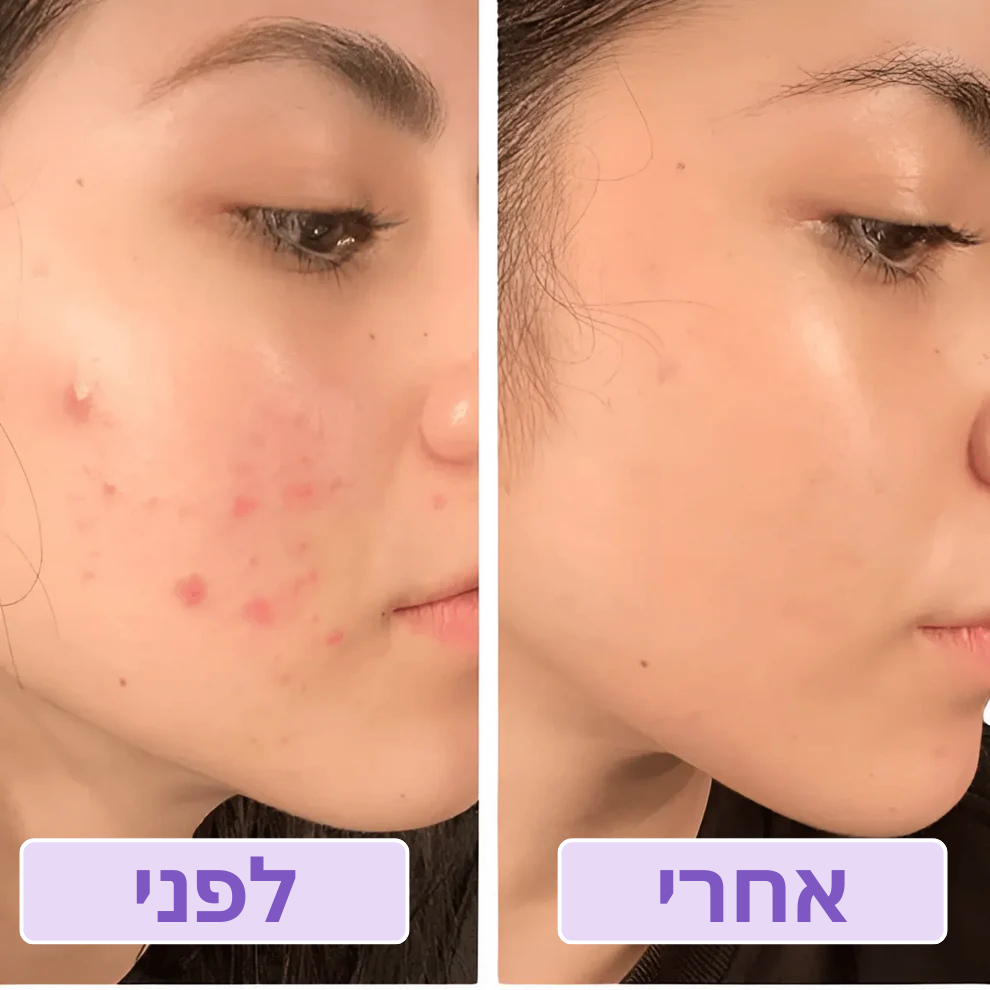 Boonality™ ראש מקלחת