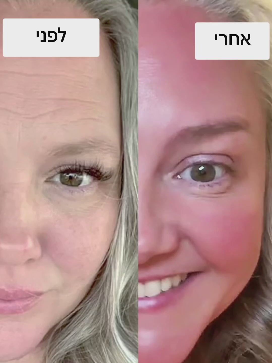 טוען וידאו: 